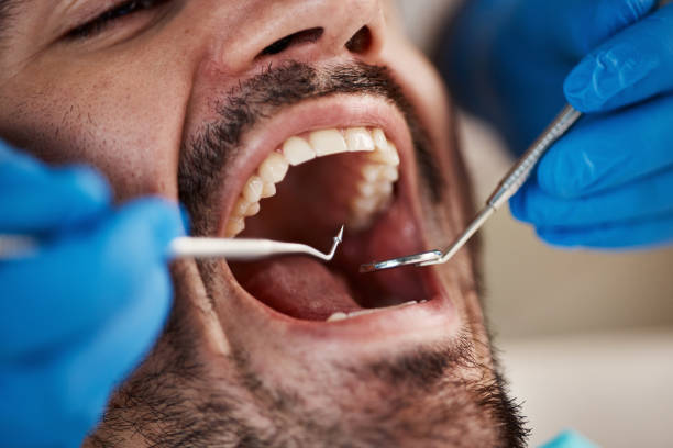 Emergency Dental Services in Jessup, MD