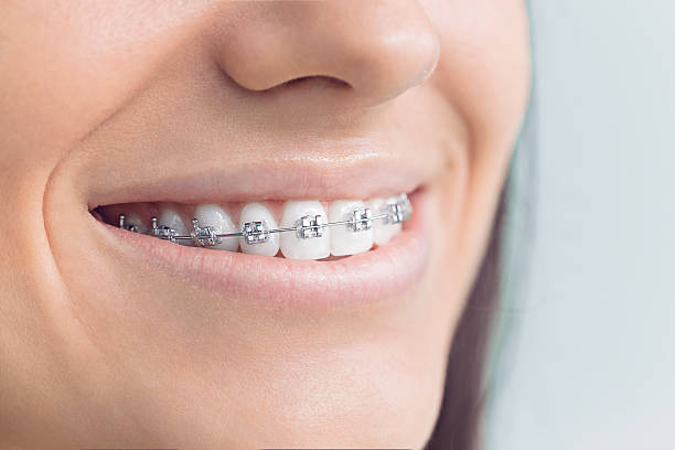 Best Teeth Whitening  in Jessup, MD